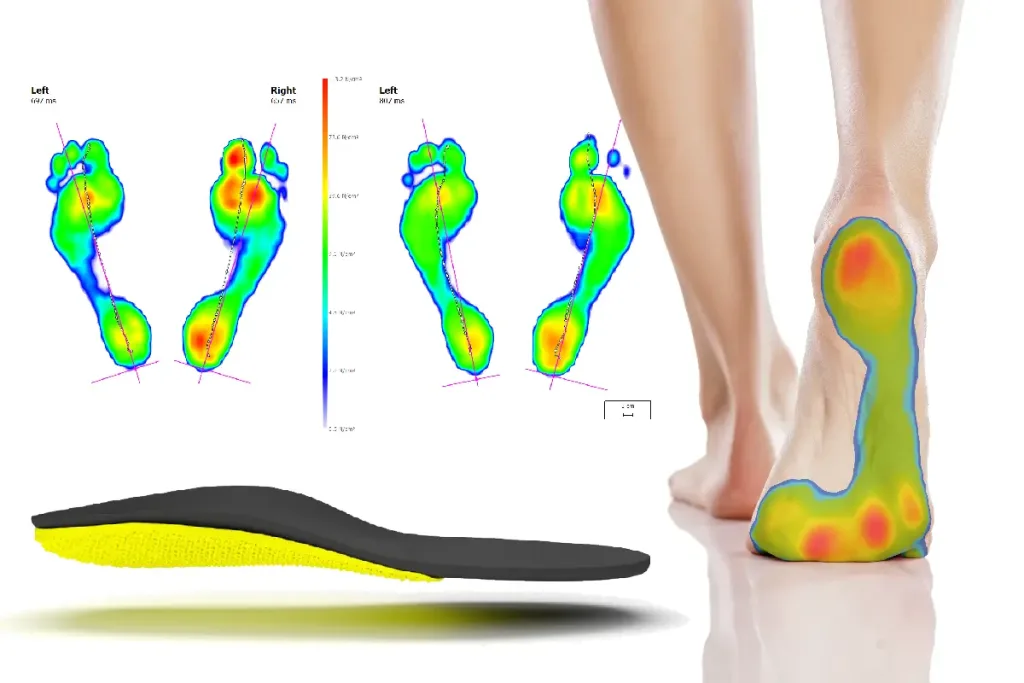scanned tech for feet Scanned feet with advanced technology that is used with GOS Labs to create 3D printed custom orthotic inserts.
